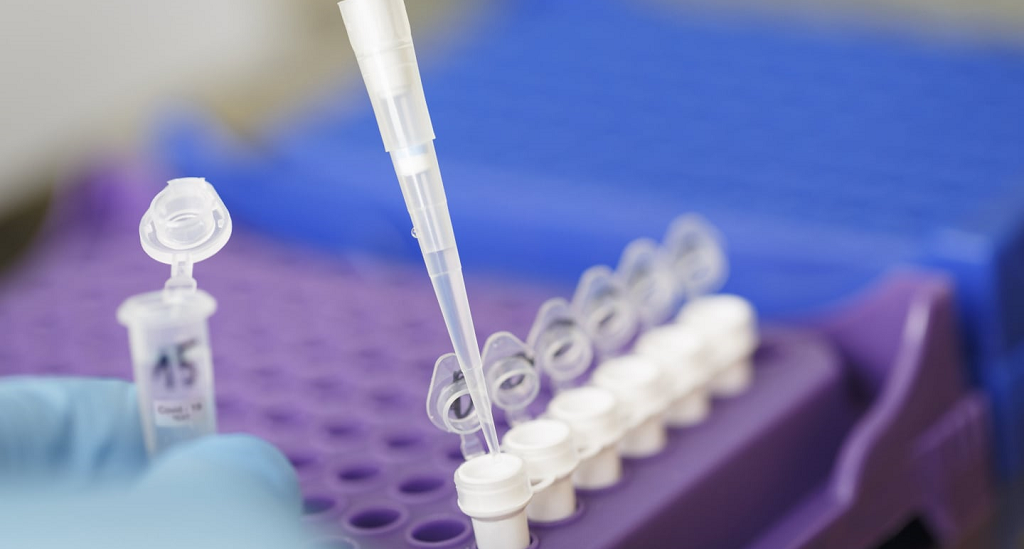 Molecular Biology – tagged