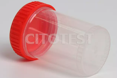 60ml URINE CONTAINER